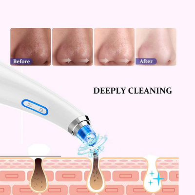 Blackhead Remover Vacuum, Pore Suction Facial Skin Vacuum Tool Blackhead Valentines Day Gifts for Her Women Him M